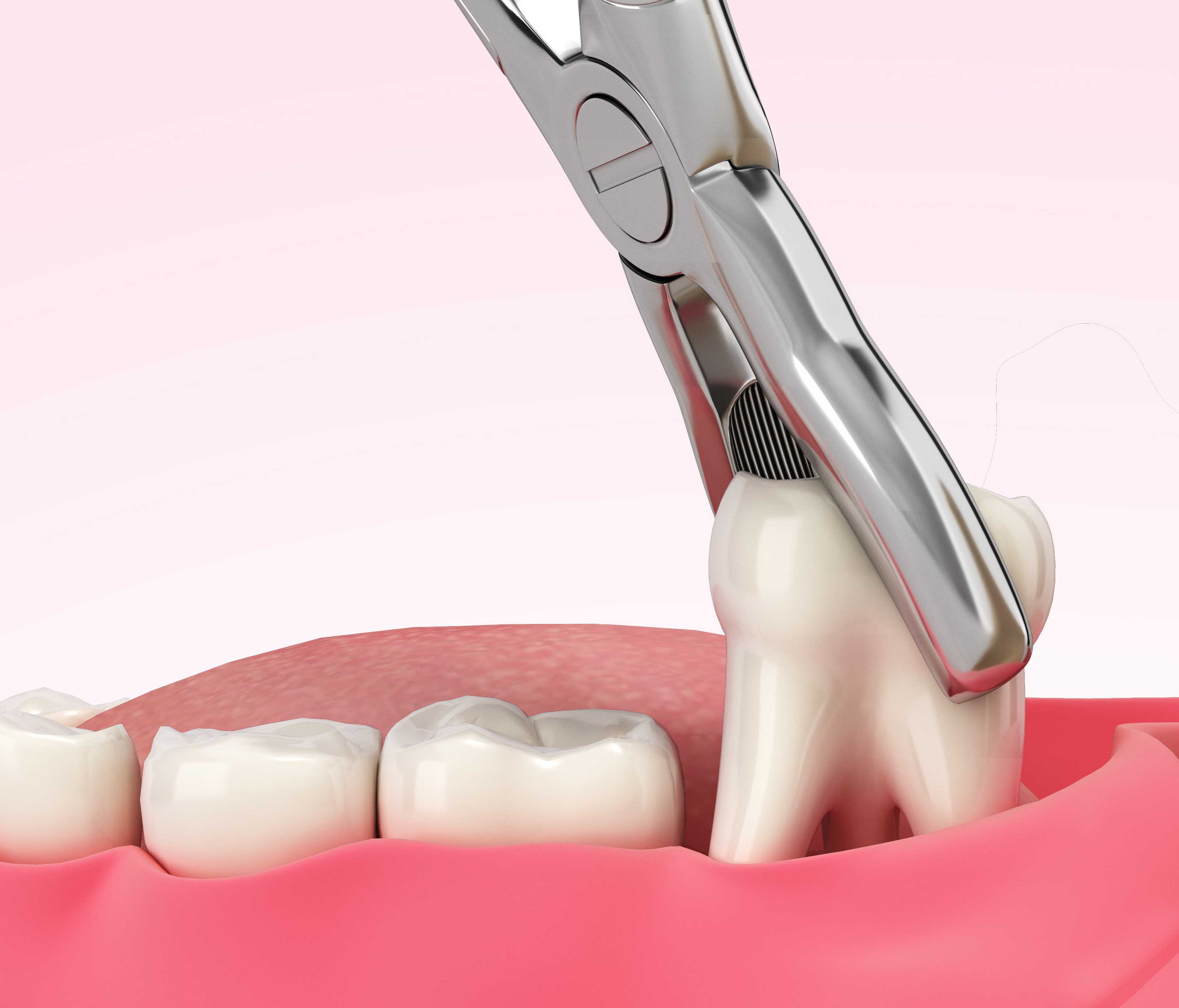 denture 様　NEIGHBORHOOD Dentures Nacogdoches, TX | Summer Enlow, DDS PC | Types of